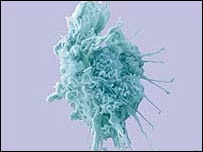20080526181210-cancerden.jpg