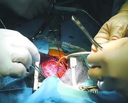 20081121041817-emer3.jpg